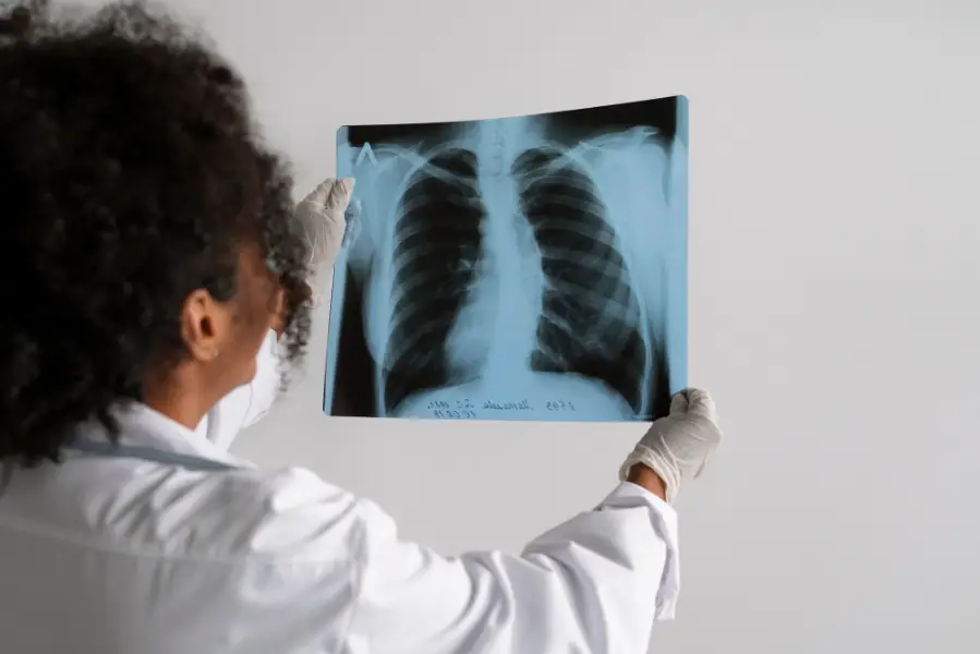 Side view doctor looking at radiography